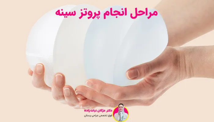 مراحل انجام پروتز سینه