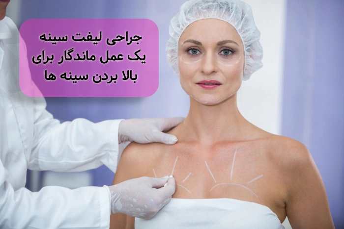 جراحی لیفت سینه