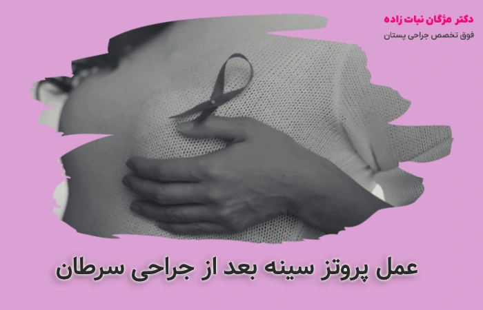 عمل پروتز بعد از جراحی سرطان سینه